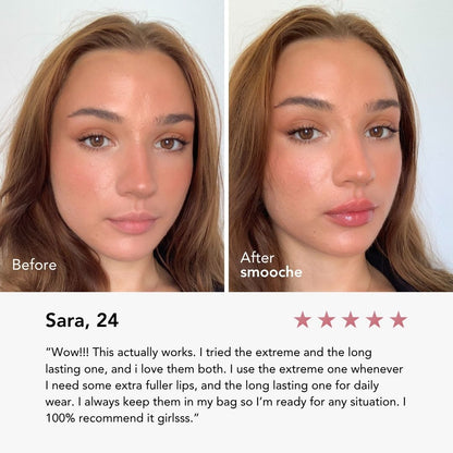 Ekstremalny Powiększacz Ust